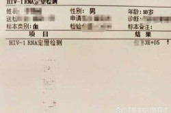 新疆新增1例确诊 系此前感染者丈夫（对确诊的艾滋病病毒感染者告知本人）