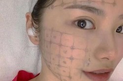 面部整形包括哪些项目？如何选择适合自己的？