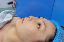 鼻部整容手术有哪些方法？哪种最自然？