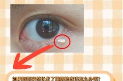 眼部脂肪粒怎么去除？有没有什么偏方？