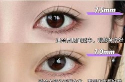 割双眼皮最好的医院是哪家？恢复期需要多久？