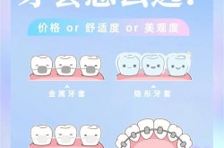 做一个牙套要多少钱？有哪些类型的牙套？