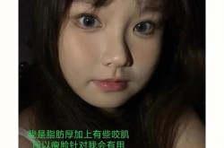 北京打瘦脸针哪家医院好？价格大概是多少？