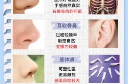 做鼻综合多少钱？鼻综合整形风险大吗？