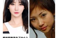 柳岩整容前后的变化大吗？如何看待明星整容现象？