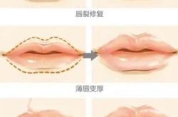 上海最好的整形医院是哪家？如何评定医院资质？