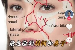 玻尿酸隆鼻后会不会有后遗症？如何避免？