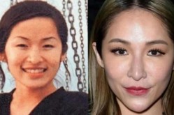 金秀炫整容前后对比，韩国明星整容有哪些风险？