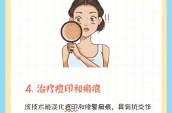 激光美肤多少钱一次？对皮肤有没有副作用？