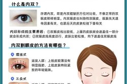 割双眼皮医院哪家恢复快？手术过程是怎样的？