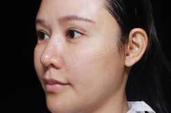手术给美女做整形的风险大吗？