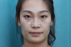 上海九院整形外科口碑如何？有没有失败的案例？