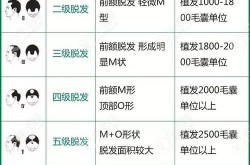 郑州植发多少钱？效果能维持多久？