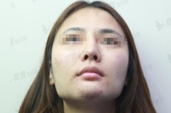 望京新城医院整形科怎么样？求真实评价