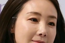 崔智友整容了吗？她的整形前后对比照哪里看？