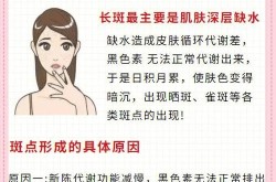激光去雀斑的价格大概是多少？会不会复发？