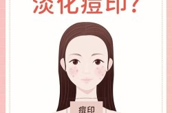 痘印痘坑怎么去除？有没有快速有效的方法？