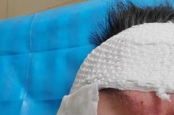 哪家的美容医院好？求真实用户体验分享！