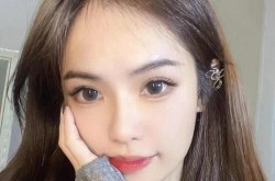 玻尿酸丰额头效果自然吗？