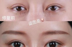 北京八大处整形医院做面部年轻化效果怎么样？