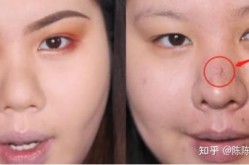 鼻梁整形医院哪家技术强？手术风险大吗？