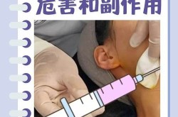咬肌切除手术安全吗？有哪些风险和注意事项？
