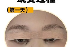 割双眼皮手术多少钱？割双眼皮前后需要注意什么？