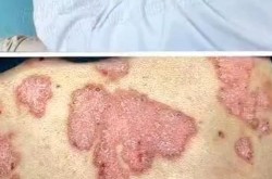 丹灶医院治疗皮肤病效果如何？有没有口碑好的医生？