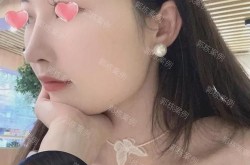 硅橡胶隆鼻的效果如何？和自体软骨隆鼻哪个好？