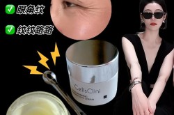 去除鱼尾纹需要多少钱？效果能维持多久？