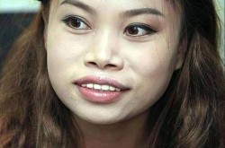 罗玉凤整容后变化大吗？她的整形经历是怎样的？