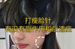 整形瘦脸针效果明显吗？有没有副作用？