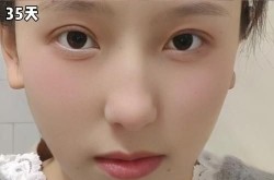 成都米亚整形怎么样？求真实评价