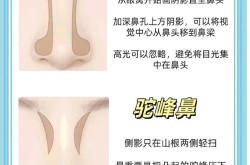 鼻子整形手术有哪些方法，哪种最自然？