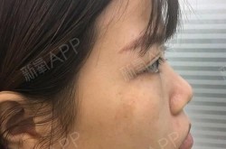 韦博整形医院的技术水平如何？有没有人去过？