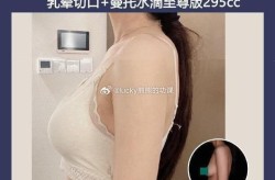 广州丰胸手术多少钱？丰胸手术安全吗？