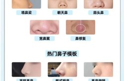 鼻尖整形大概多少钱？效果自然吗？