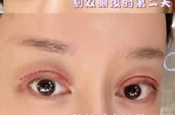 王府井整形医院哪家好？价格透明吗？