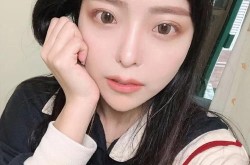自体脂肪丰面部手术的优缺点是什么？