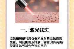 哪种祛斑方法效果最好？有没有亲身经历的推荐？