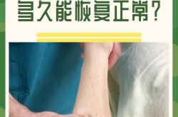 抽脂手术费用大概是多少？术后多久能恢复正常？