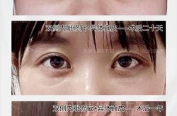 张冰洁整形前后对比照曝光，她整了哪些地方？