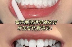 谁做过牙齿美白？效果明显吗？
