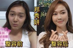 韩国女明星整容前后差别大吗？整形有哪些风险？