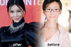 巩新亮整容前后的对比照曝光，整形效果如何？