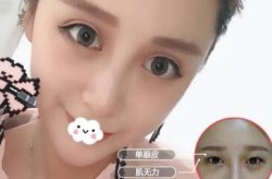 二炮整形医院口碑如何？求真实评价和案例分享