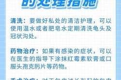包皮切除手术费用高吗？术后恢复需要注意什么？