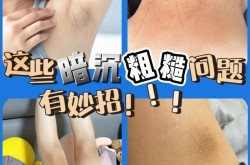 脖子美白方法有哪些？如何去除脖子的暗沉？