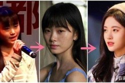 脸部整形效果自然吗？有没有后遗症？