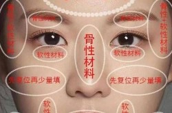 找玻尿酸医生，如何判断其专业水平？